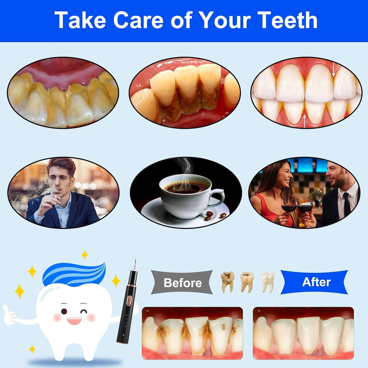 Plaque Remover for Teeth, Tartar Remover for Teeth Cleaning with 4 Replaceable Heads and 3 Adjustable Modes, Rechargeable Teeth Cleaning Plaque Remover for Home