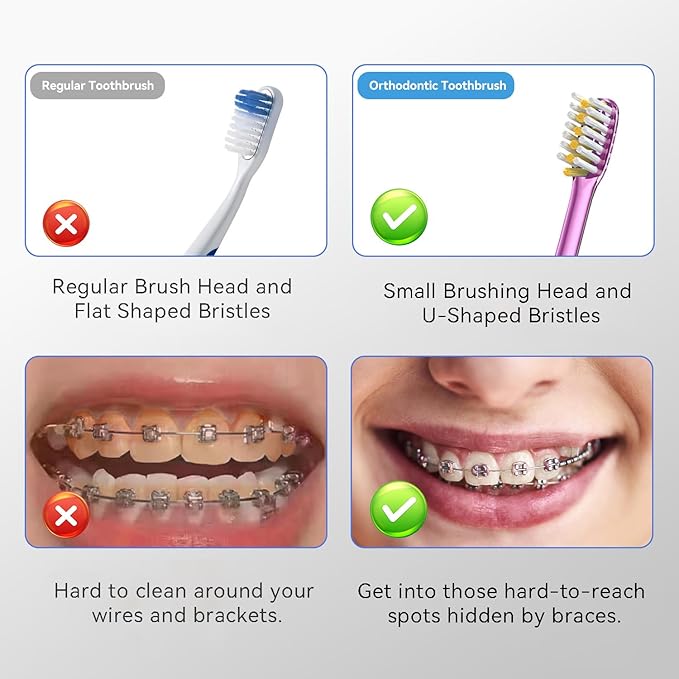 JTF Orthodontic Manual Toothbrush for Braces: 6 U-Shaped Tooth Brush with 6 Interdental Brushes, Ultra-Durable Bristles for Stain Removal and Deep Oral Clean, Toothbrushes for Tooth with Dental Device