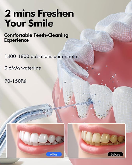Water Flosser Teeth Pick: 300ML & LED Display 5 Modes Rechargeable Dental Flossers for Braces,Sensitive Gums, Portable Flossing for Teeth Cleaning, IPX7 Waterproof Cordless for Home Travel Use