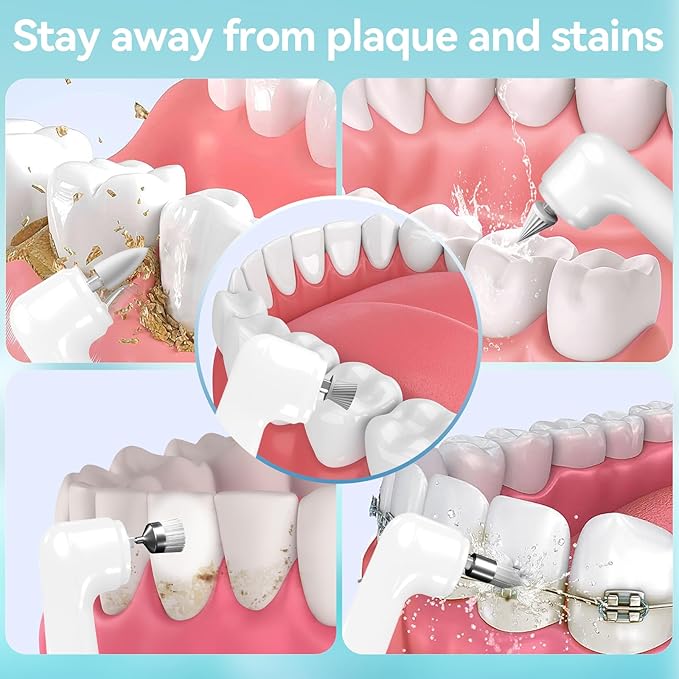 Tooth Polisher with 5 Replacement Heads and Clean Mode, Tooth Polisher Electric Professional USB Charging, IPX6 Waterproof for Adults & Kids White