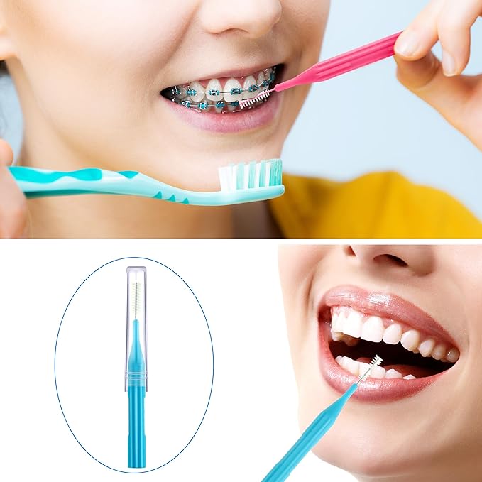 Patelai 100 Pieces Braces Brush for Cleaner Interdental Brush Toothpick Dental Flossing Head Oral Hygiene Flosser Tooth Cleaning Tool(Light Blue,Pink,Yellow,Orange)