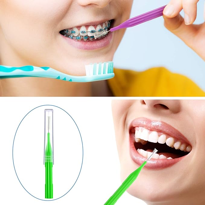 Patelai 50 Pieces Braces Brush for Cleaner Interdental Brush Between Teeth Toothpick Flosses Dental Flossing Head Oral Hygiene Tooth Cleaning Tool(Light Blue, Purple, Yellow, Gray, Light Green)