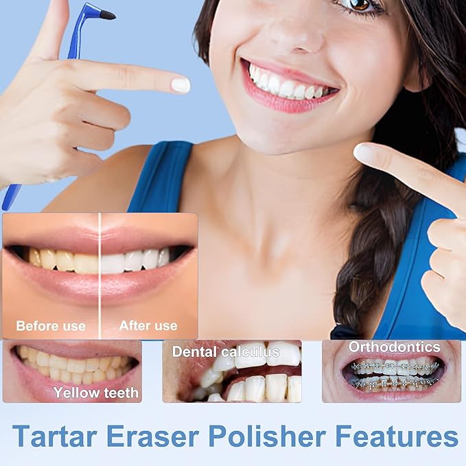 3Pcs Teeth Stain Remover,Tooth Stain Eraser,Tartar Eraser Polisher,Dental Plaque Tool,Eraser for Coffee Stain Teeth Whitening Cleaning Polishing Kit (Blue)