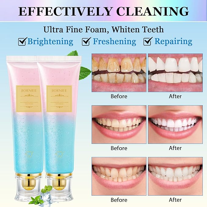 2PCS Niacinamide Toothpaste, Niacinamide Whitening Toothpaste, Niacinamides Intensive Whitening Toothpastes, Fresh Breath, Remove Tooth Stains