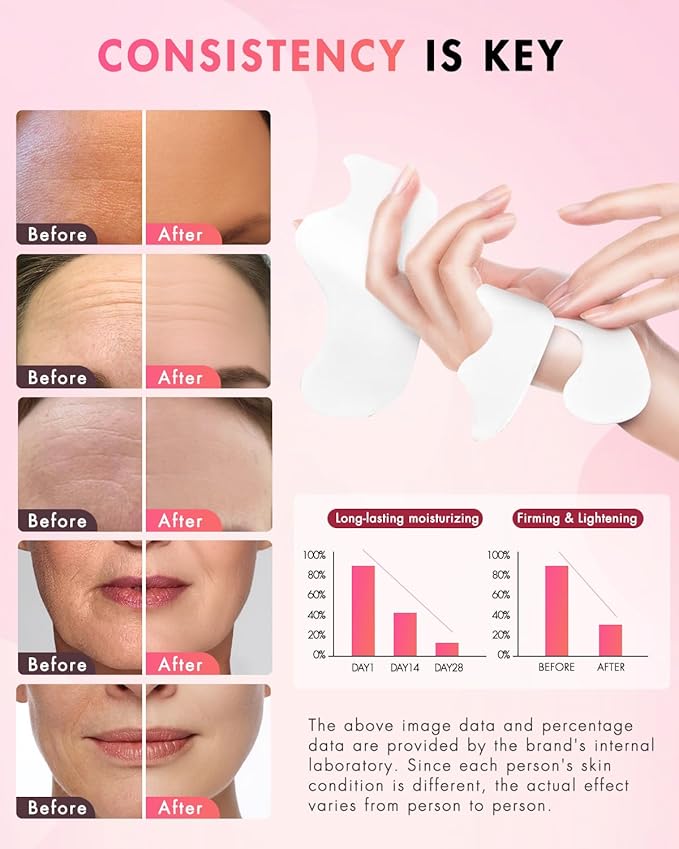 Forehead Wrinkle Patches & Smile Line Patches, Overnight Facial Wrinkle Treatment with Hyaluronic Acid, Aloe, Collagen & Vitamin E to Lift Smile Lines for Women 36pcs with Face Retinol Cream