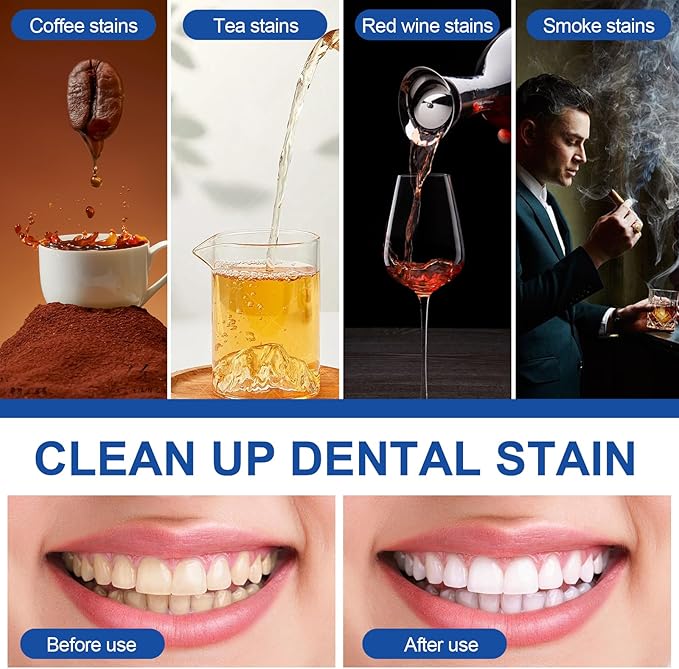 2 Count Teeth Whitening Pen, Teeth whitening Stick,Teeth White Gel, Great for Tooth Whitening, User-Friendly, Beautiful White Smile, Mint Flavor