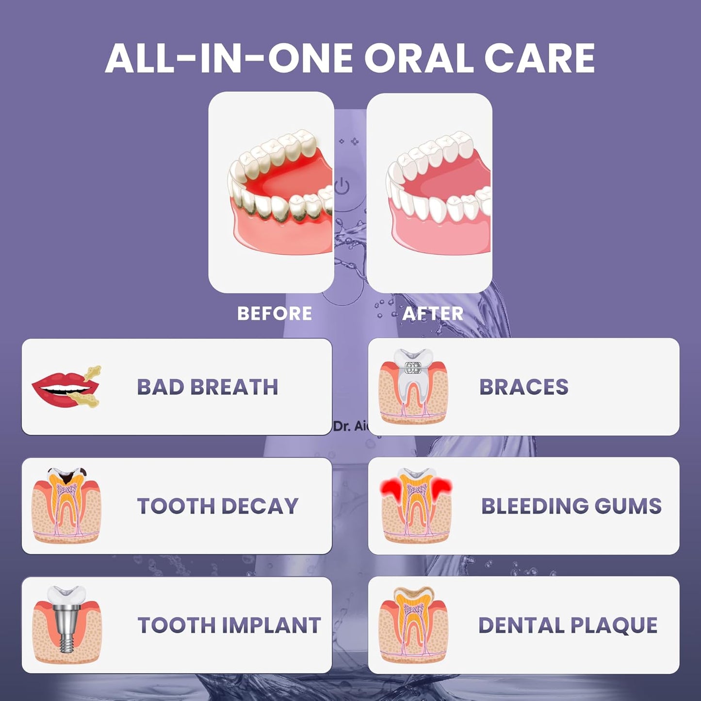 Dr. Aid Dental Water Flosser – Portable Oral Irrigator – 11Oz Tank, Water Filter, 5 Tips, Magnetic Charger – IPX8 Waterproof Cordless Water Flosser, Ideal Water Flossers for Teeth, Gums, Braces, White