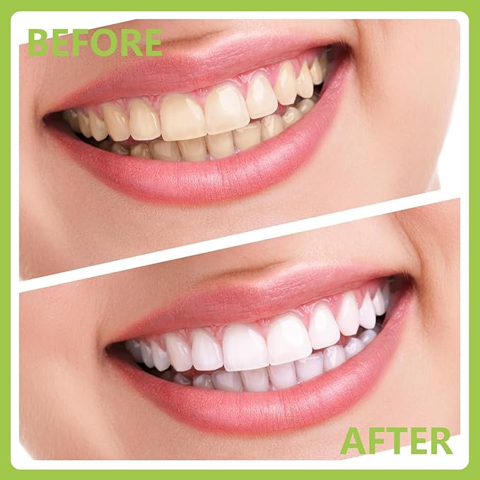 11 Pack Dental Tools PARYUNGR Teeth Cleaning Tool Kit, Stainless Steel Tongue Scraper Tartar Plaque Remover Tooth Cleaner Dental Floss Picks Mouth Mirror, Professional Oral Care Hygiene Set with Case