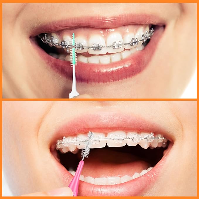 Zopeal 250 Pieces Braces Flossers Interdental Brush for Cleaner Tooth Toothpick Dental Teeth Flossing Picks Head Oral Dental Hygiene Cleaning Tool Soft Cleaners(Cute Color)