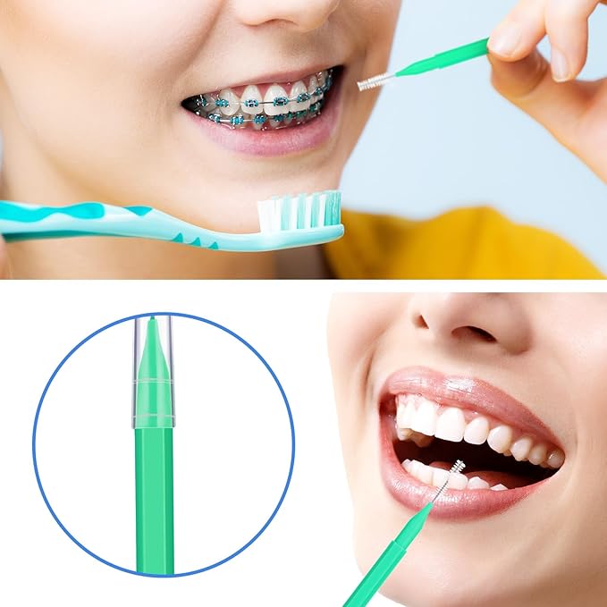 Patelai 100 Pieces Braces Brush for Cleaner Interdental Brush Toothpick Dental Tooth Flossing Head Oral Dental Hygiene Flosser Toothpick Cleaners Tooth Cleaning Tool(Green, Yellow,Mixed Sizes)