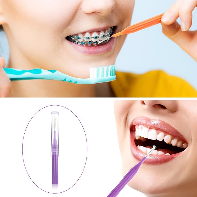 Patelai 100 Pieces Braces Brush for Cleaner Interdental Brush Toothpick Dental Flossing Head Oral Hygiene Flosser Tooth Cleaning Tool(Orange,Yellow, Light Blue, Purple, Grey)