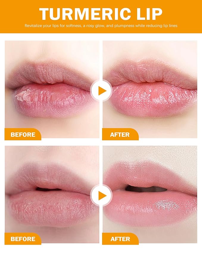 2PCS Turmeric Lip Balm,Hydrating Turmeric Lip Balm with Turmeric Oil For Dark Lips, Long-Lasting Natural Nourishing Balm Moisturizer for Dry, Cracked Lips Exfoliator Scrub Softening Lip Care Set