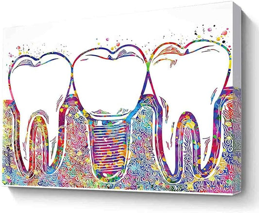 MBARE Watercolor Art,Dental Implant Art Watercolor Print Tooth Dental Clinic Decor Dentistry Student Science Dentist Gift Doctor~-12"X16" Canvas Print With Frame