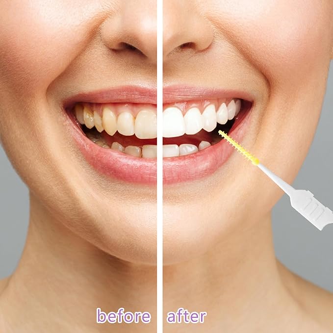 250 Pieces Interdental Brushes, Silicone Dental Floss Picks with Case Dental Brushes Dental Picks Tooth Floss Picks for Teeth Cleaning(Yellow, Purple)