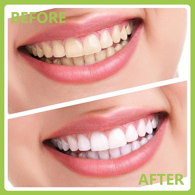 8 Pack Dental Tools PARYUNGR Teeth Cleaning Tool Kit, Stainless Steel Scraper Plaque Tartar Remover Tooth Cleaner Dental Floss Picks, Professional Oral Care Hygiene Set for Personal Pet Use with Case