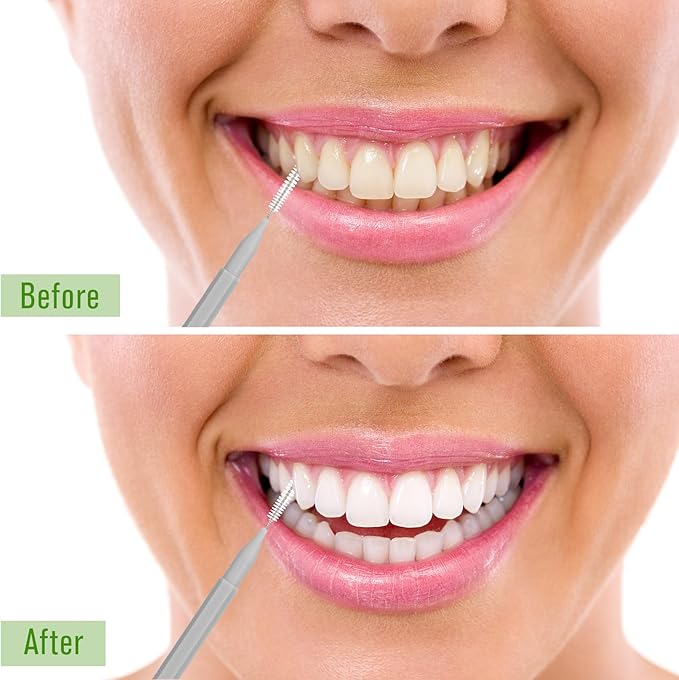 Patelai 100 Pieces Braces Brush for Cleaner Interdental Brush Toothpick Dental Tooth Flossing Head Oral Dental Hygiene Flosser Toothpick Cleaners Tooth Cleaning Tool (Gray)