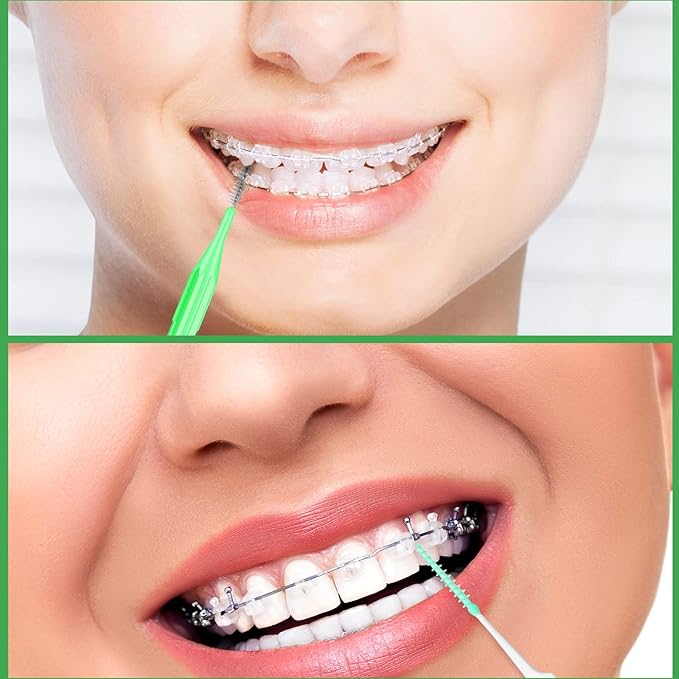 Zopeal 250 Pieces Braces Flossers Interdental Brush for Cleaner Tooth Toothpick Dental Teeth Flossing Picks Head Oral Dental Hygiene Cleaning Tool Soft Cleaners(Fresh Color)