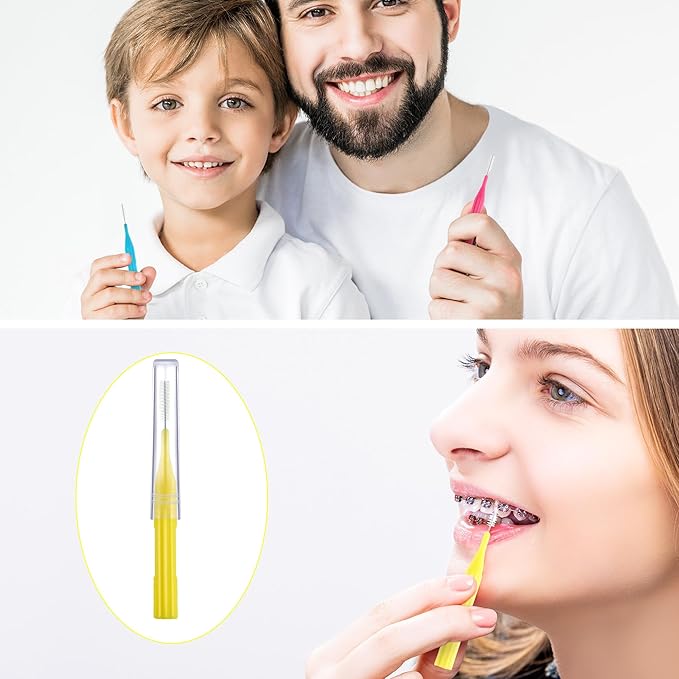 Patelai 100 Pieces Braces Brush for Cleaner Interdental Brush Toothpick Dental Flossing Head Oral Hygiene Flosser Tooth Cleaning Tool(Light Blue,Pink,Yellow,Orange)