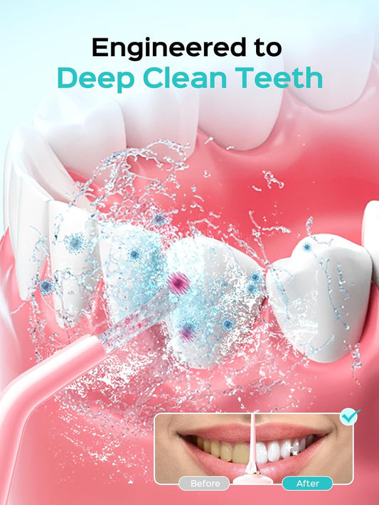 COSLUS Portable Water Flosser for Teeth: 10 Pressure Settings Professional Water Dental Pick for Orthodontic, Braces & Sensitive Gums - Cordless for Travel Use, for Adults Teens, BPA-Free, E40