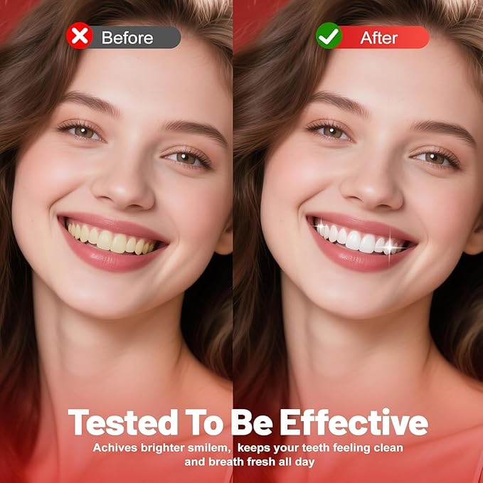 Sp-6 Probiotics Whitening Toothpaste - Sp6 Brightening Tooth Paste Enhanced Super Probiotic Formula Deep Cleaning Fresh Breath Dental Gum Health Oral Microbiota Strength Enamel Care