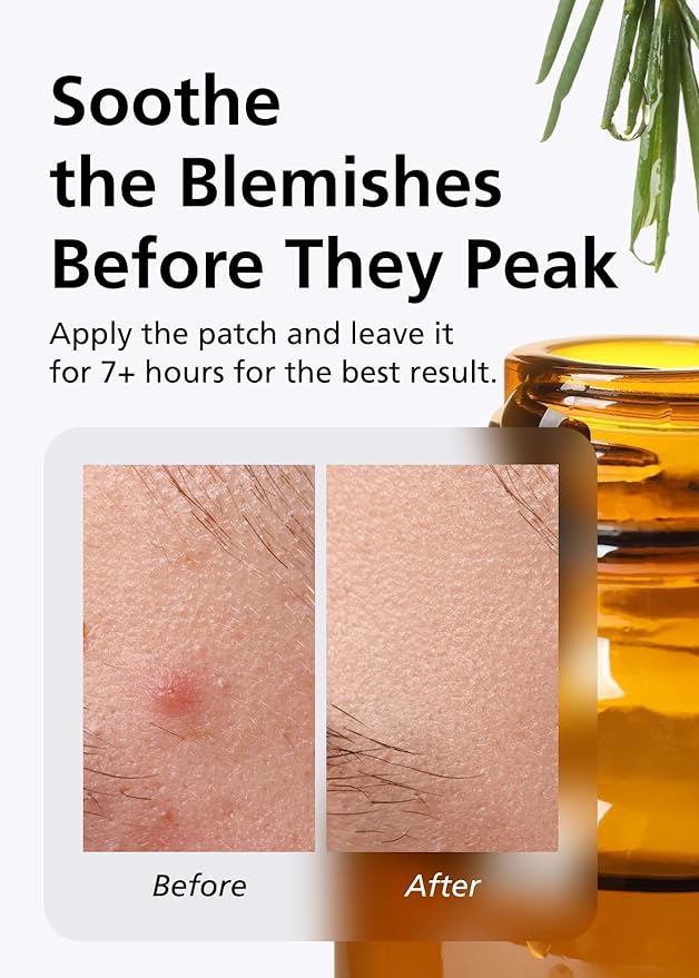 EasyDerm Relief Invisible Patch(42 counts) I Contains 10,000ppm of Tea Tree Oil, Pimple Patch, Ultra-slim 0.1mm, Waterpoof, Korean Pimple Patches Stocking Stuffer Holiday Gift MUST HAVE