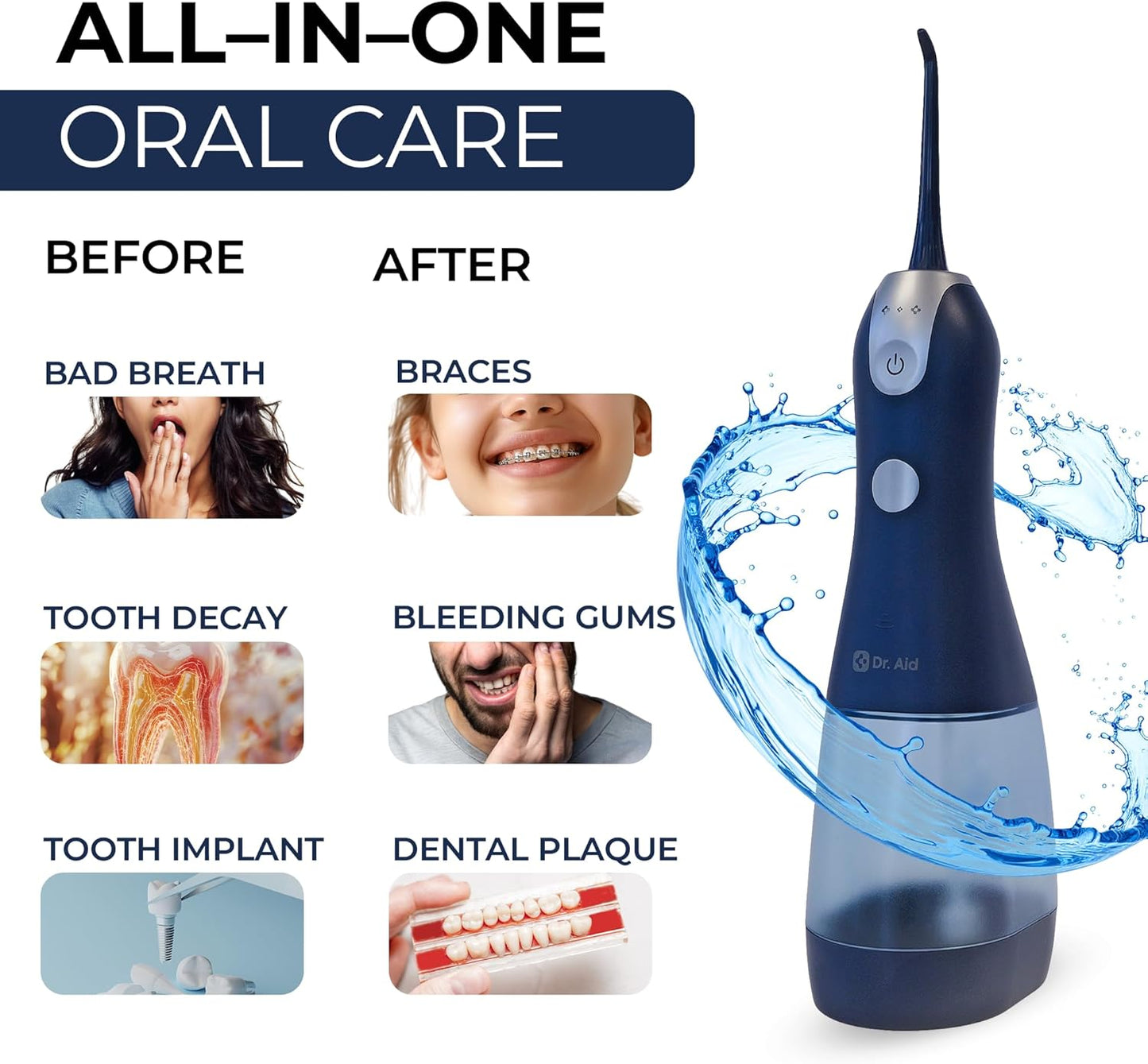 Dr. Aid Dental Water Flosser – Portable Oral Irrigator – 11Oz Tank, Water Filter, 5 Tips, Magnetic Charger – IPX8 Waterproof Cordless Water Flosser, Ideal Water Flossers for Teeth, Gums (Dark Blue)