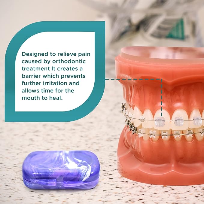 Orthodontic Dental Wax for Braces – Premium Braces Wax in Designer Marble Cases, Tooth Wax for Braces, Clear & Unscented, 6-Pack Assorted Colors