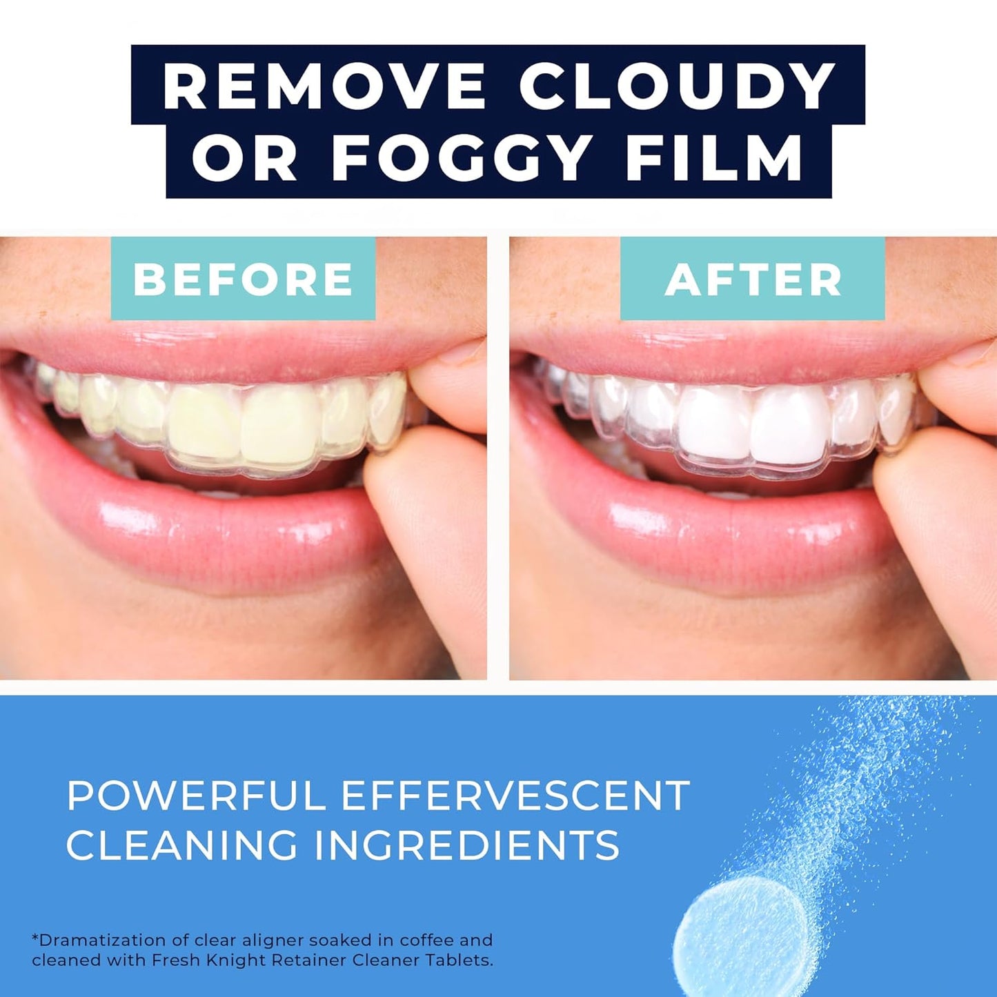 Retainer Cleaner Tablets 120 - Invisalign Cleaner - Denture Cleaner. Efferdent Retainer Cleaner Tablets, Night Guard, Mouth Guards, Aligners & Dental Appliance Cleaner - 4 Month Supply.