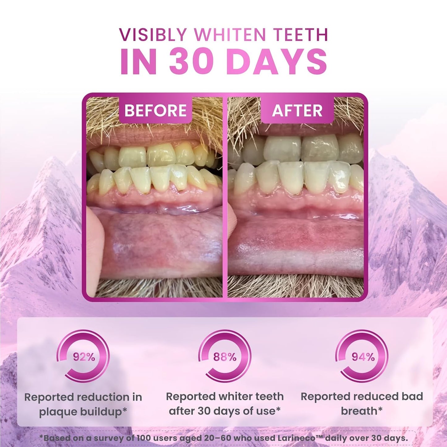 Larineco Remineralizing Gum with Nano Hydroxyapatite & Xylitol – Sugar-Free Cinnamon Xylitol Gum – Plastic-Free, Dye-Free, Aspartame-Free – Natural Base – 18 Pieces (18 Count (Pack of 2), Bubble Gum)