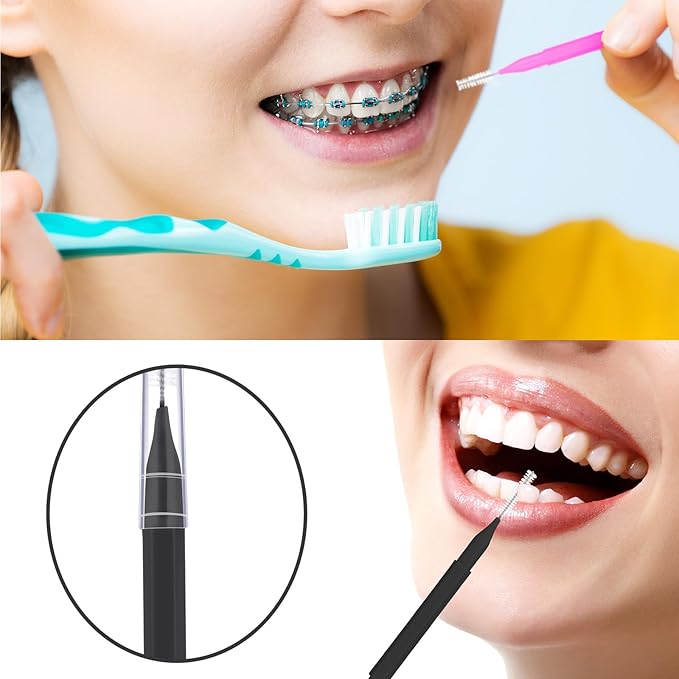 Patelai 100 Pieces Braces Brush for Cleaner Interdental Brush Toothpick Dental Tooth Flossing Head Oral Dental Hygiene Flosser Toothpick Cleaners Tooth Cleaning Tool(White, Black, Pink,Proper Size)