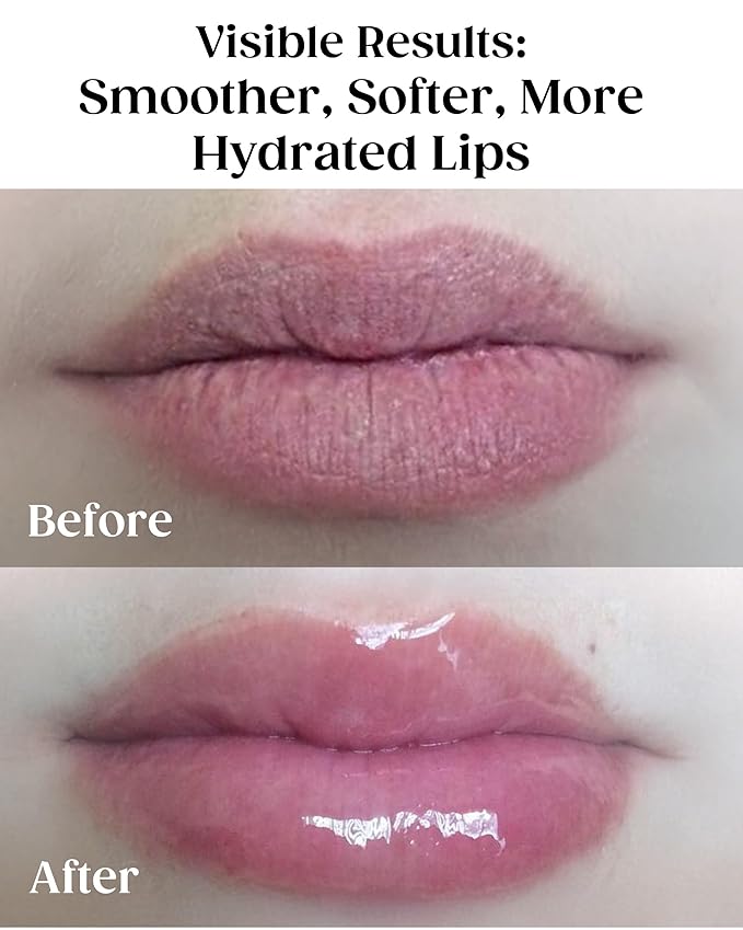 KAPLAN MD Perfect Pout Lip Mask & SPF 30 Lip Balm Duo – Hydrating Treatment with Hyaluronic Acid – Lip Mask (1 oz) + Rose Blush Balm (0.35 oz)