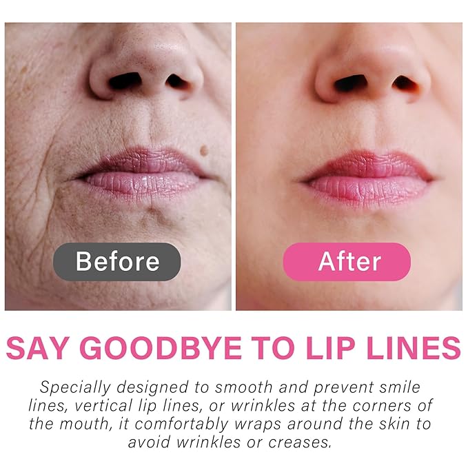 Josera Anti Wrinkle Patches for Lip, Smile Line Patches, Overnight Smoothing Anti-Wrinkle Face Patches for Smile Line & Lip Area, 18 Pcs