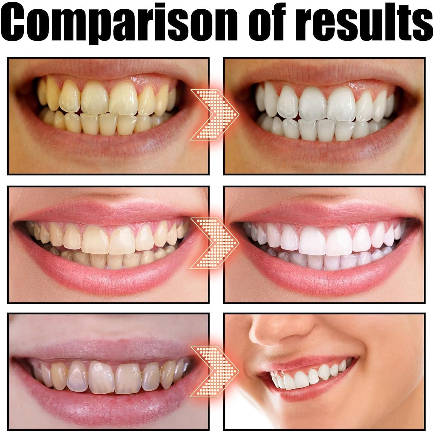 Coconut Oil Pulling for Teeth Whitening-Cocofresha Powerful Organic Coconut Peppermint Pulling Oil for Teeth and Gums, Pure Mouthwash Mint Freshness, Natural Cleanse, 4 Oz (2)