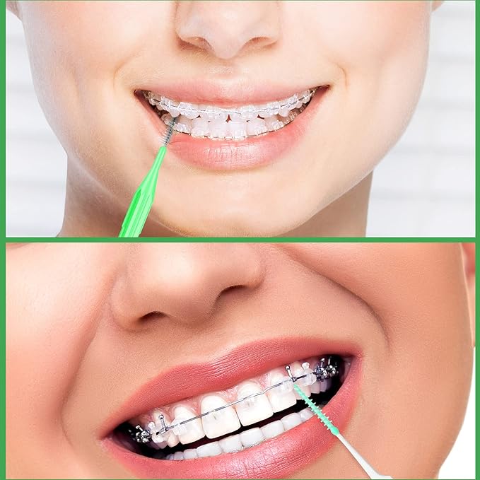 Zopeal 250 Pieces Braces Flossers Interdental Brush for Cleaner Tooth Toothpick Dental Teeth Flossing Picks Head Oral Dental Hygiene Cleaning Tool Soft Cleaners