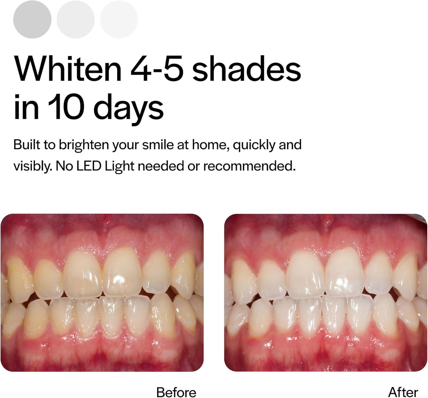 Opalescence Go 15% Mint - Prefilled Teeth Whitening Trays - 15% Hydrogen Peroxide - (10 Treatments) Made by Ultradent Products. Teeth Whitening Kit -Mint - Includes 2Chill Toothbrush 5194-1T