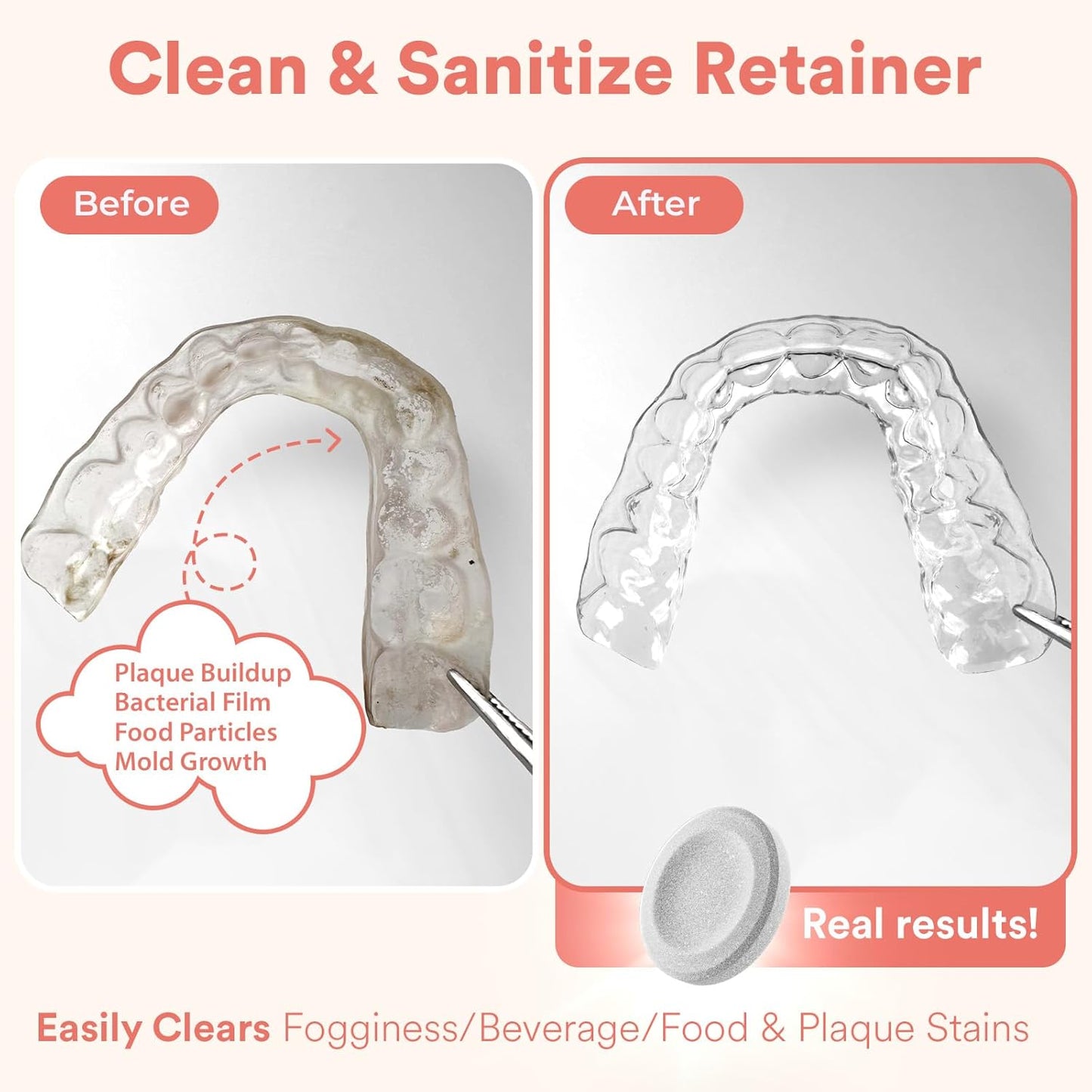 Weiss Naturals Retainer Cleaning Tablets, Invisalign Cleaner, Remove Stains, Odors & Plaque, FSA & HSA Eligible, Night Guard Cleaner PERSULFATE & DYE-FREE 1-Month Supply, Denture Cleaners, 30 Tablets