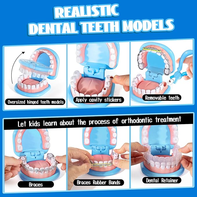 Dentist Playset for Boys with Oversized Pretend Teeth /Removable Teeth /Braces /Retainer - Kids Doctors Play Set - Teeth Model for Teaching - Role Play Toys for Kids 4-6 (Blue)