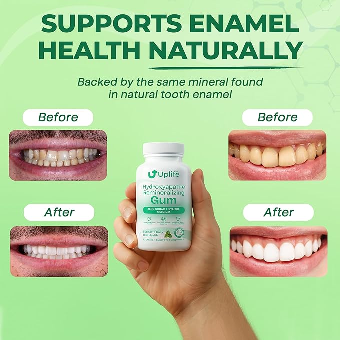 Uplife Hydroxyapatite Remineralizing Gum – Sugar-Free Xylitol Chewing Gum – Supports Daily Oral Health & Fresh Breath – Zero Sugar, Mint Flavor, 62 Pieces