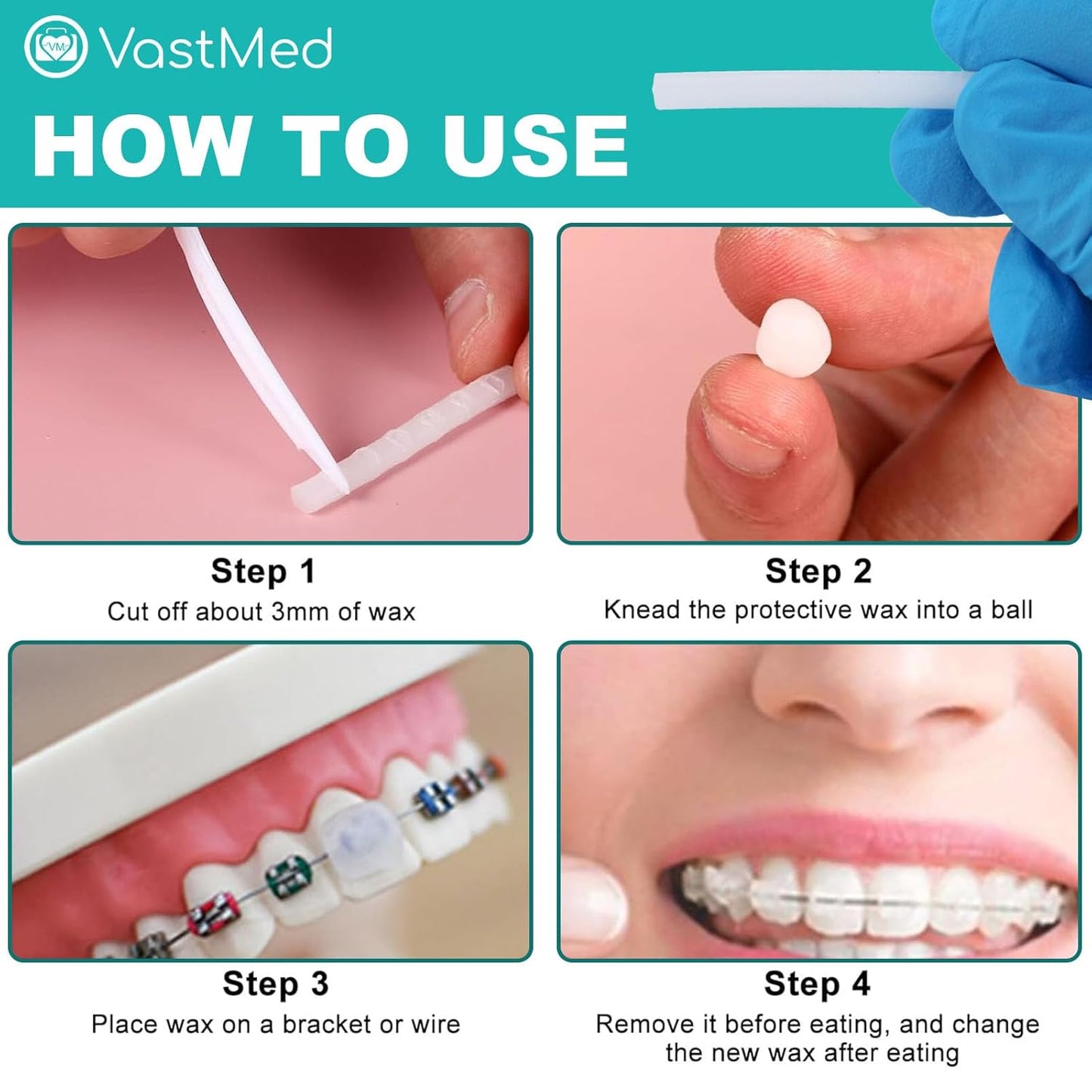 20 PCs (5 Per Box) Orthodontic Wax for Braces & Aligners by VASTMED | Dental Grade Braces Wax for Teeth with Colorful Storage Cases | Food Grade Ortho Brace Wax