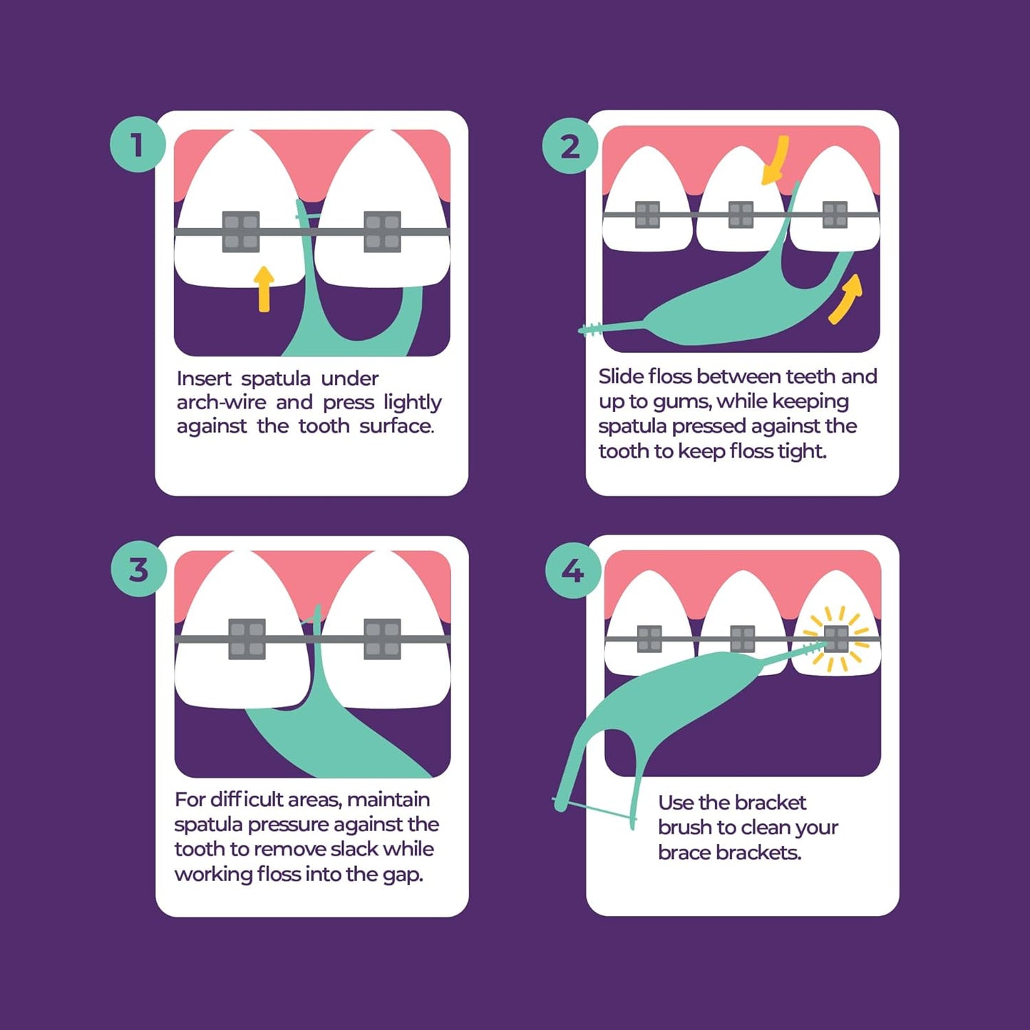 Platypus Orthodontic Flossers for Braces, 40 Count (Pack of 1), Ortho Picks for Adults & Kids, Fits Under Arch Wire, Non-Damaging, Encourage Flossing Habits