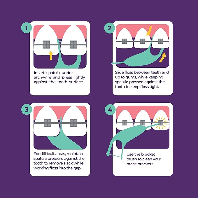 Platypus Orthodontic Flossers for Braces, 30 Count (Pack of 3), Ortho Picks for Adults & Kids, Fits Under Arch Wire, Non-Damaging, Encourage Flossing Habits