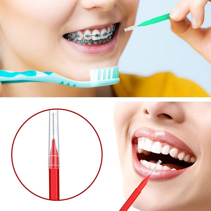 Patelai 100 Pieces Braces Brush for Cleaner Interdental Brush Toothpick Dental Tooth Flossing Head Oral Dental Hygiene Flosser Toothpick Cleaners Tooth Cleaning Tool(Green, Red,Proper Size)