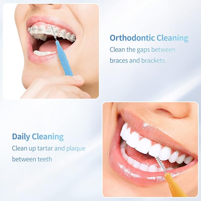 Annhua 50 Pcs Interdental Brushes Floss Braces Brush for Cleaner Interdental Brushes Between Teeth, Dental Brush Picks Flosser Tooth Cleaning Tool Mixed Sizes