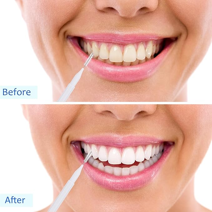 Patelai 100 Pieces Braces Brush for Cleaner Interdental Brush Toothpick Dental Tooth Flossing Head Oral Dental Hygiene Flosser Toothpick Cleaners Tooth Cleaning Tool (Black, White, Gray)