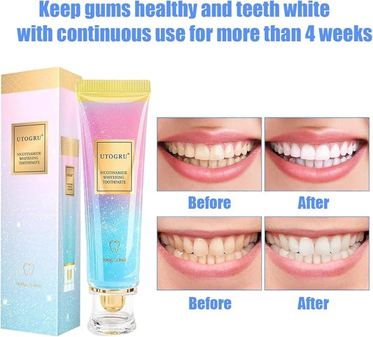 Niacinamide Whitening Toothpaste, Utogru Teeth Radiant Whitening Toothpaste - Enamel Care, Repair and Protect Teeth, Fresh Breath (2Pcs