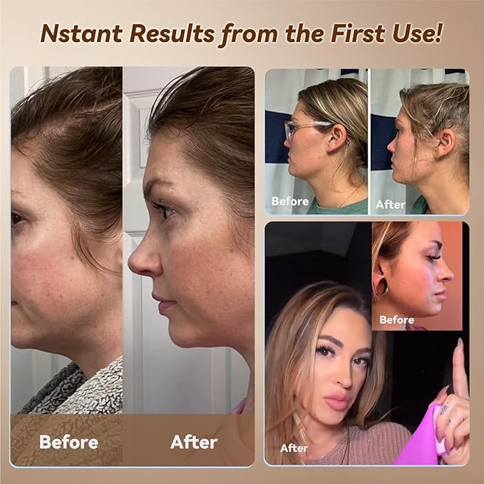 JUSRON V-Line Mask Chin Up Mask Face Strap, Soft Silicone Chin Strap V Shaped Face Mask, Jaw Exerciser 23-27 Inches (Light Blue)