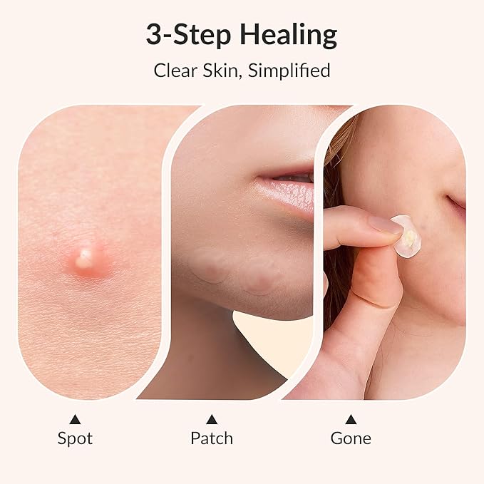 Korean Pimple Patches – 4 Size Invisible Acne Stickers with Salicylic Acid & Hydrocolloid Miracle Patches for Pimples Zit Stickers Blemish Dots Pimple Stickers for Face - 36 Count