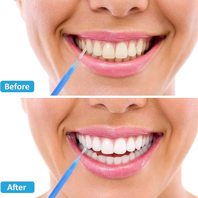 Patelai 100 Pieces Braces Brush for Cleaner Interdental Brush Toothpick Dental Tooth Flossing Head Oral Dental Hygiene Flosser Toothpick Cleaners Tooth Cleaning Tool (Blue, Red,Suitable Size)