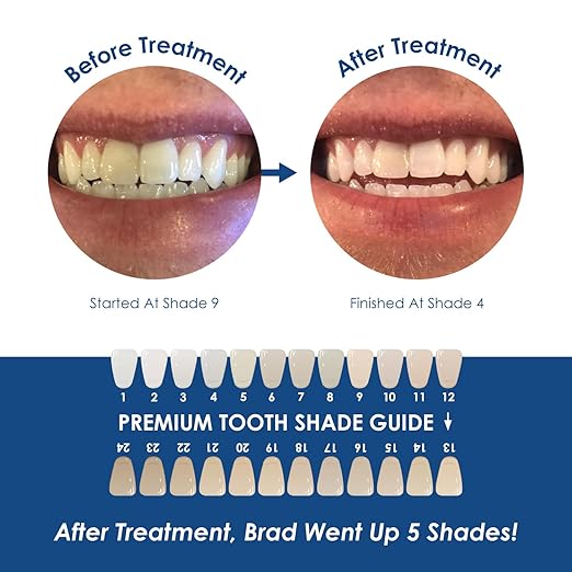 Professional Dental-Grade Teeth Whitening Gel, Sensitivity-Proof, 9% Hydrogen Peroxide Formula - Made in USA - 4 Pack Syringes with Dispensing Tips