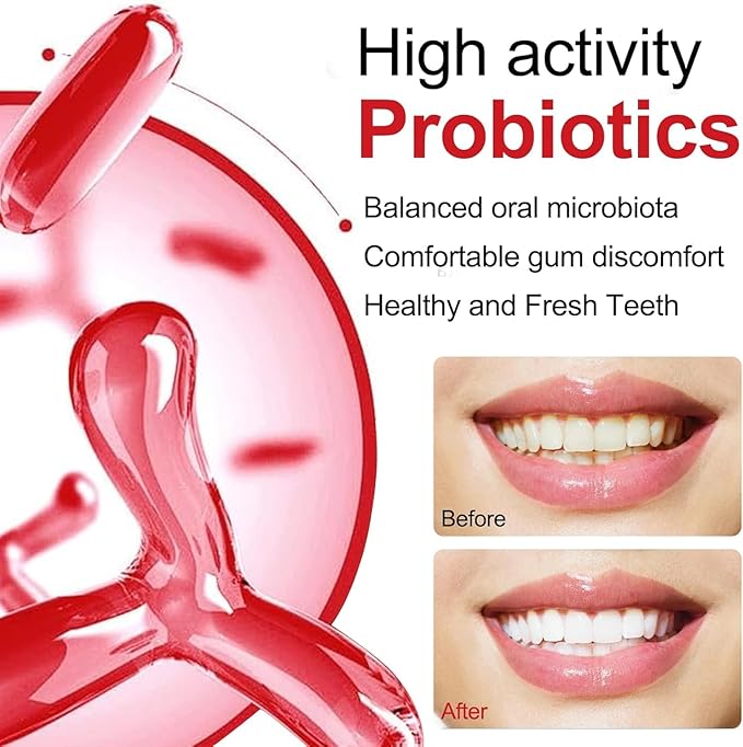 2PC SP-10 Probiotic Whitening Toothpaste – Fresh Breath, Deep Cleaning, Stain Removal– Natural Formula